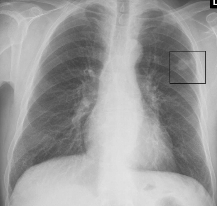 immagine La tubercolosi del cane e del gatto: che cos'è e come prevenirla